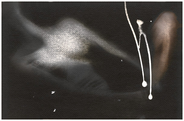 click on the picture to reduce it again